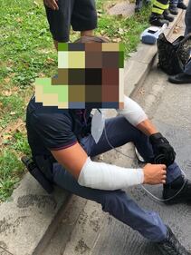 Milano, si dà fuoco in strada: le foto degli agenti feriti 1
