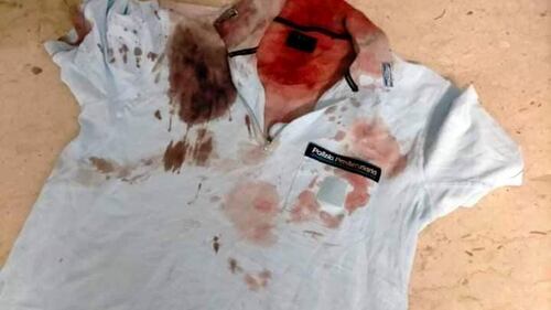 Le foto degli agenti picchiati dai detenuti nelle carceri 4