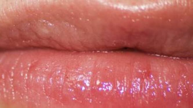 Labbra, i rimedi per proteggerle in inverno