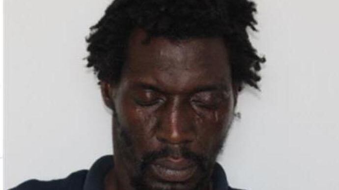 Il grave "errore" dietro l'attacco: così il clandestino ha preso a bottigliate il turista