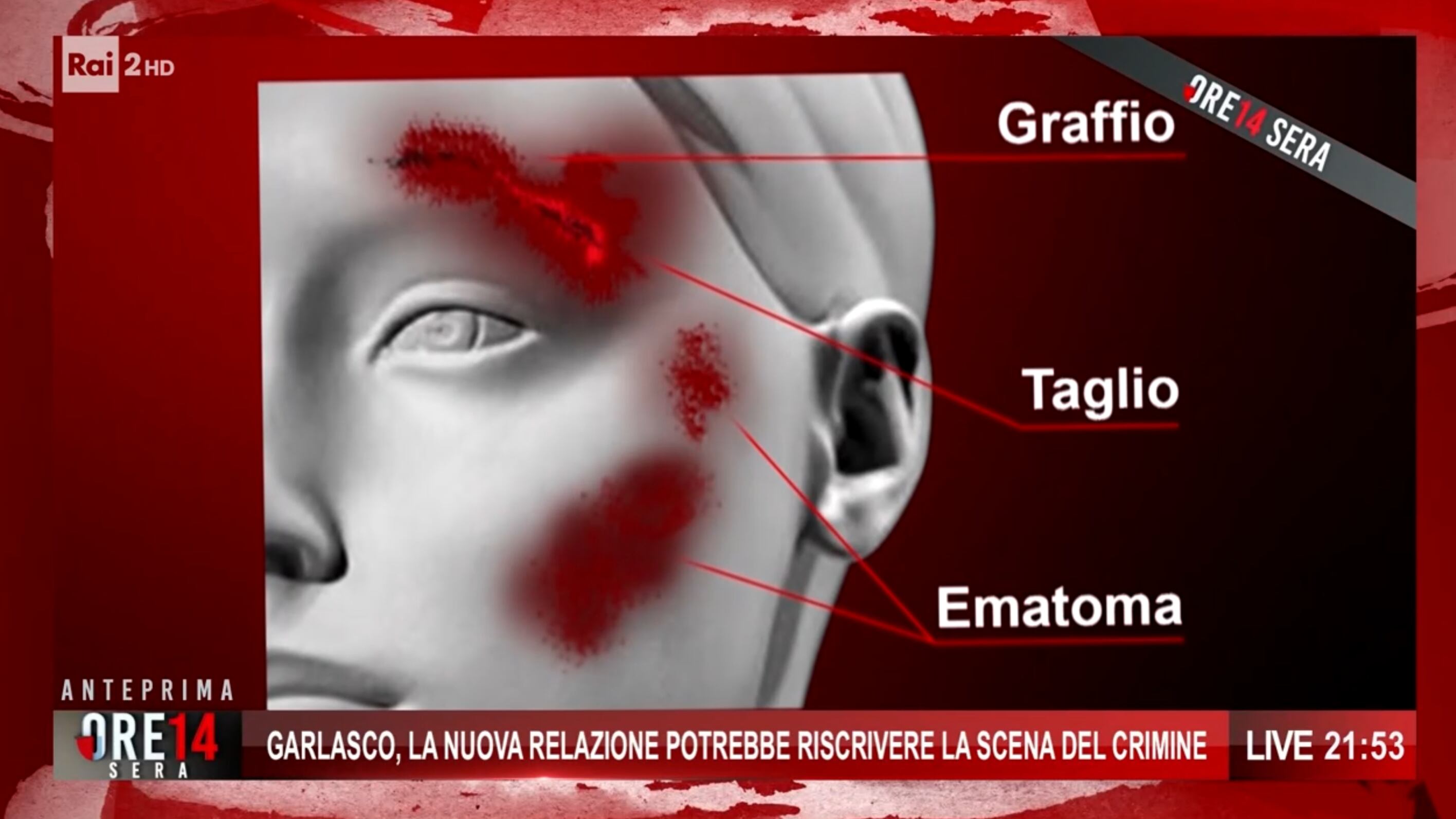 Delitto di Garlasco: il giallo del foro sul volto di Chiara. "Stasi via dalla scena del crimine"