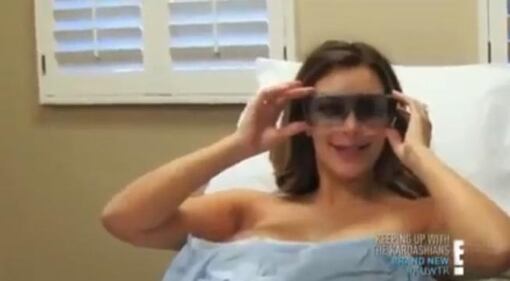 Kim Kardashian, laser sul seno per rimuovere le smagliature 4
