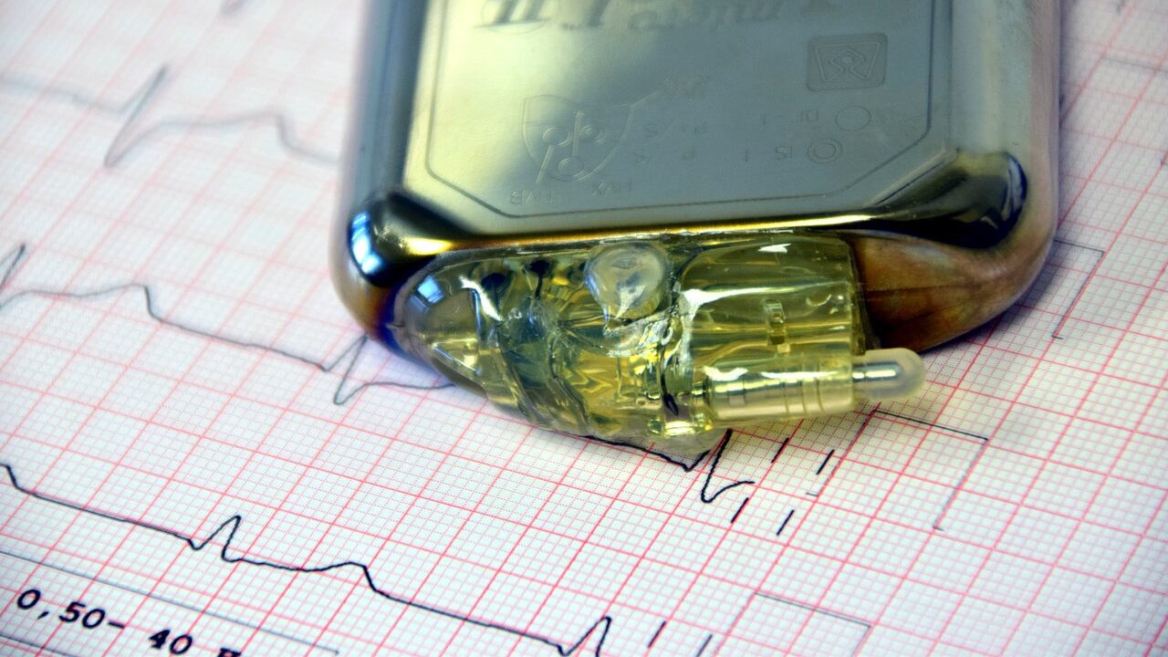 Pacemaker, così smartphone e fitness tracker ne alterano il funzionamento