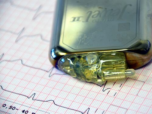 Pacemaker, così smartphone e fitness tracker ne alterano il funzionamento