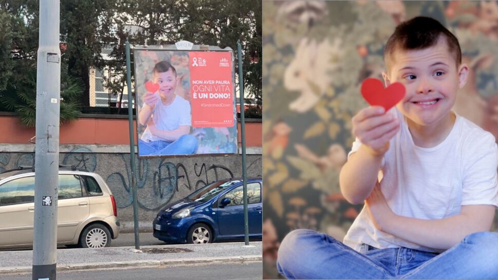 "Il cromosoma in più delle persone con sindrome di Down è un valore"