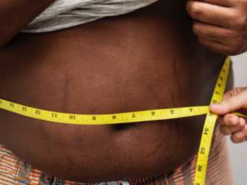 Obesità, uno studio rivela: riduce la materia grigia del cervello