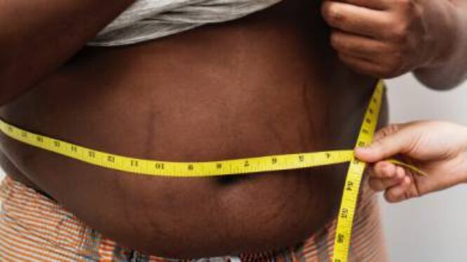 Obesità, uno studio rivela: riduce la materia grigia del cervello
