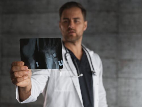 Osteoporosi, cure inadeguate nell'80% dei casi