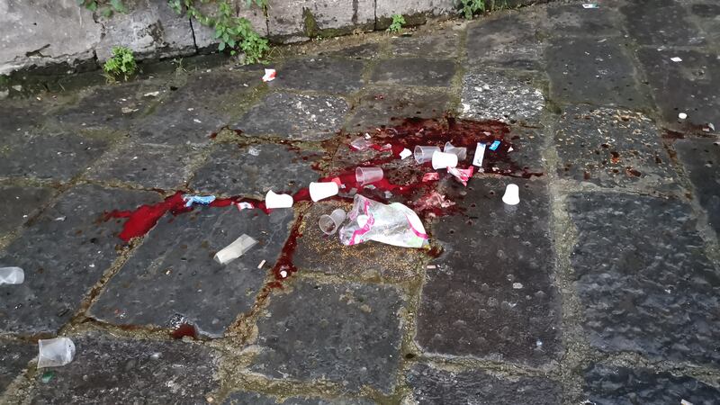 Napoli, sangue tra rifiuti e siringhe a Porta Capuana 7