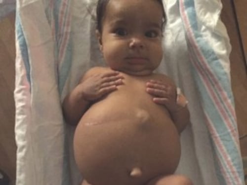 Pubblica le foto choc della figlia malata al fegato: "Donate"