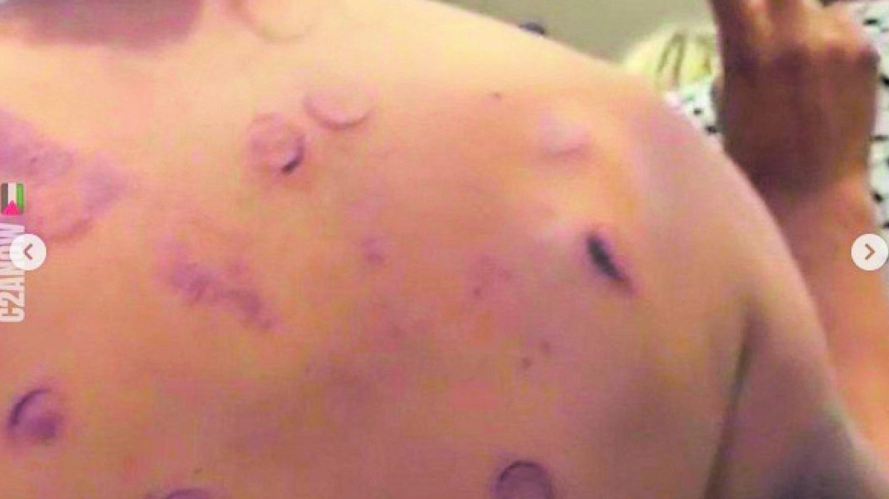 I militanti pro Pal mostrano i lividi. L'ipotesi: reati di stupro e tortura
