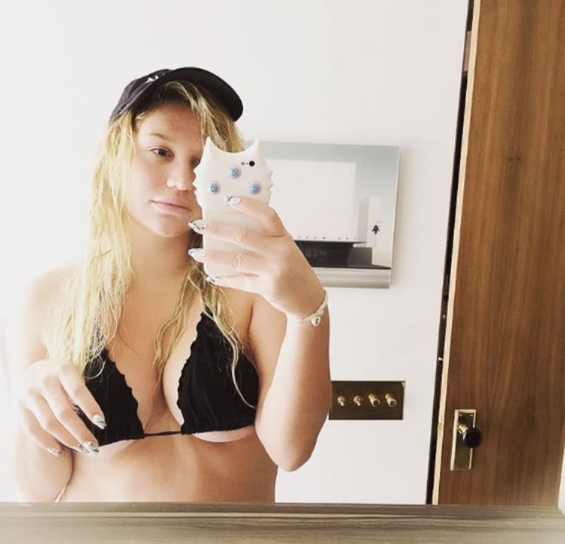 kesha