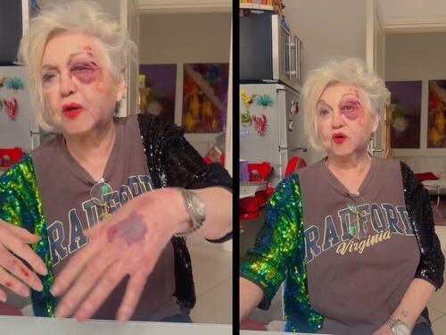 "La macchina, i sassi, il dolore incredibile", Wanna Marchi investita da un'auto a Milano