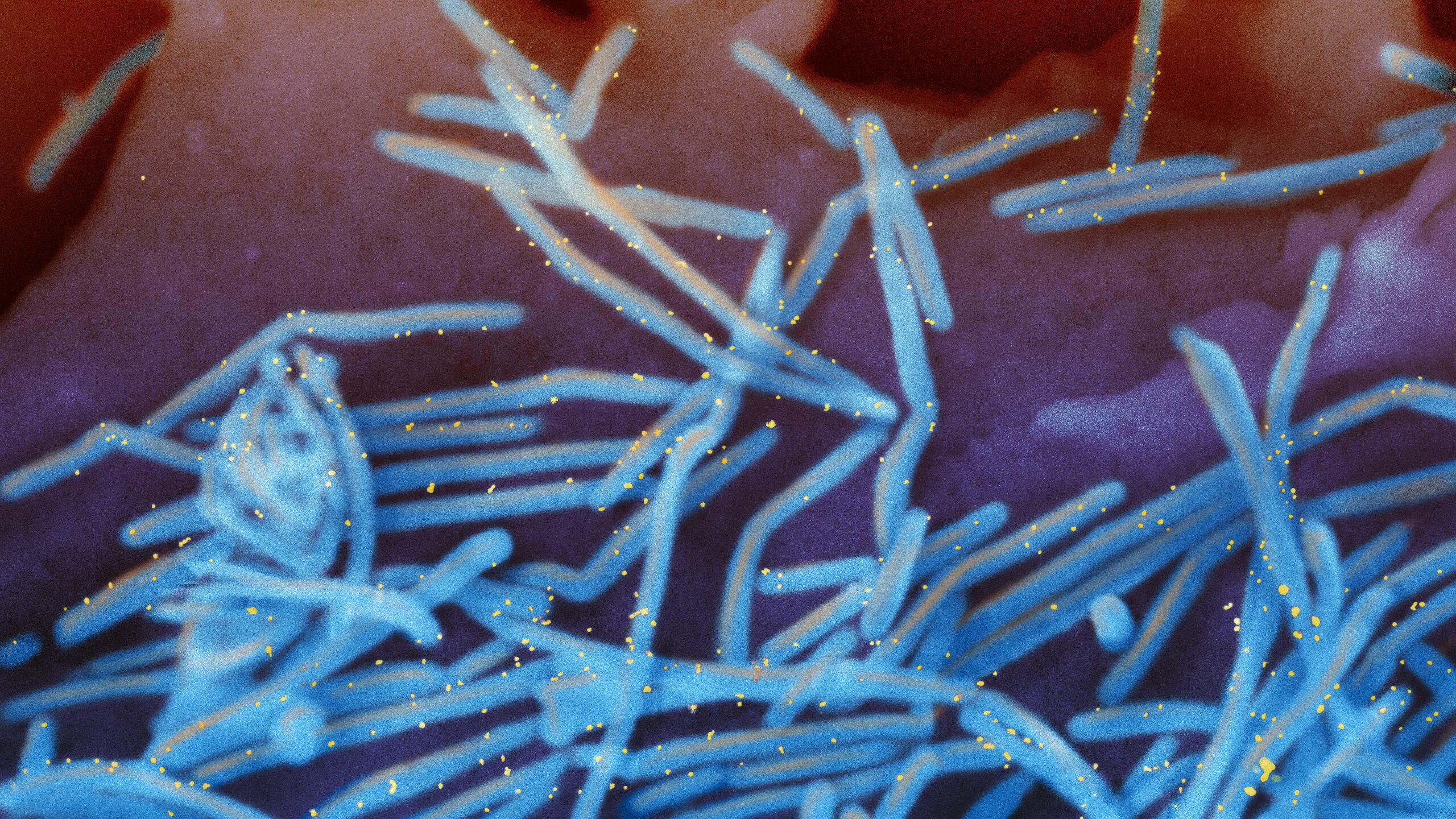 Virus sinciziale, primo caso in Italia: ecco i sintomi e come colpisce
