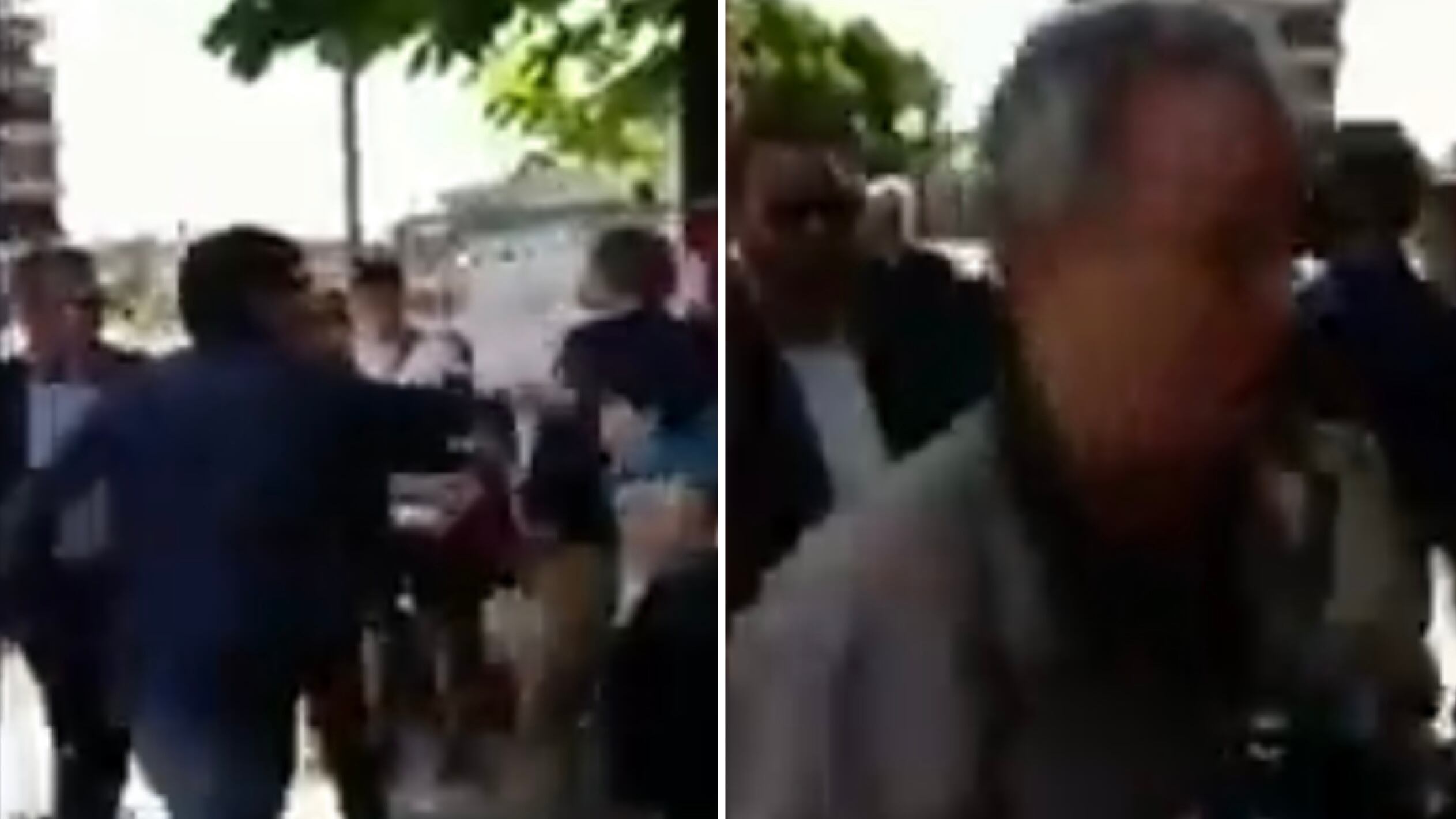 Conte aggredito da un no vax: colpito al volto in piazza durante un evento a Massa