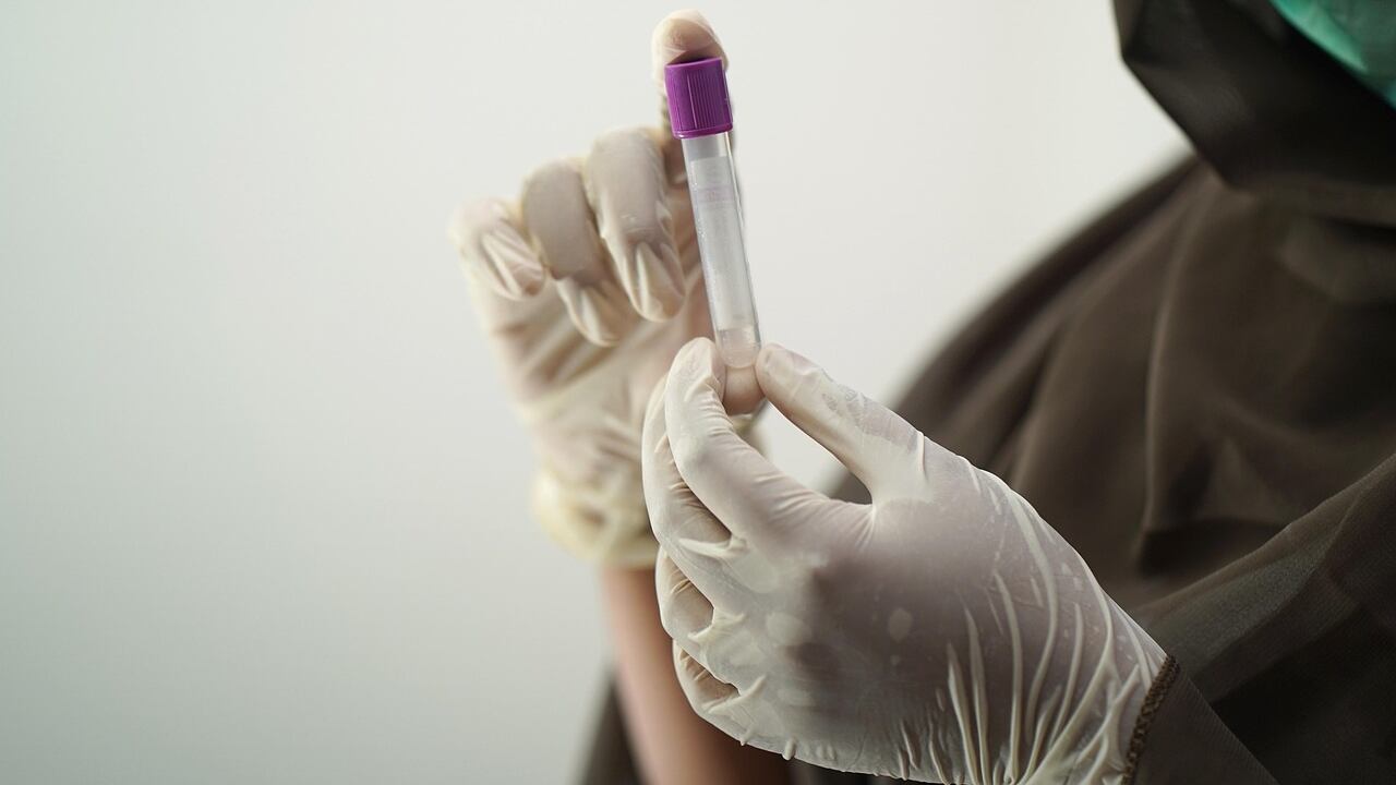 Botulino: cos’è, sintomi, rischi e cure dell’intossicazione alimentare più pericolosa