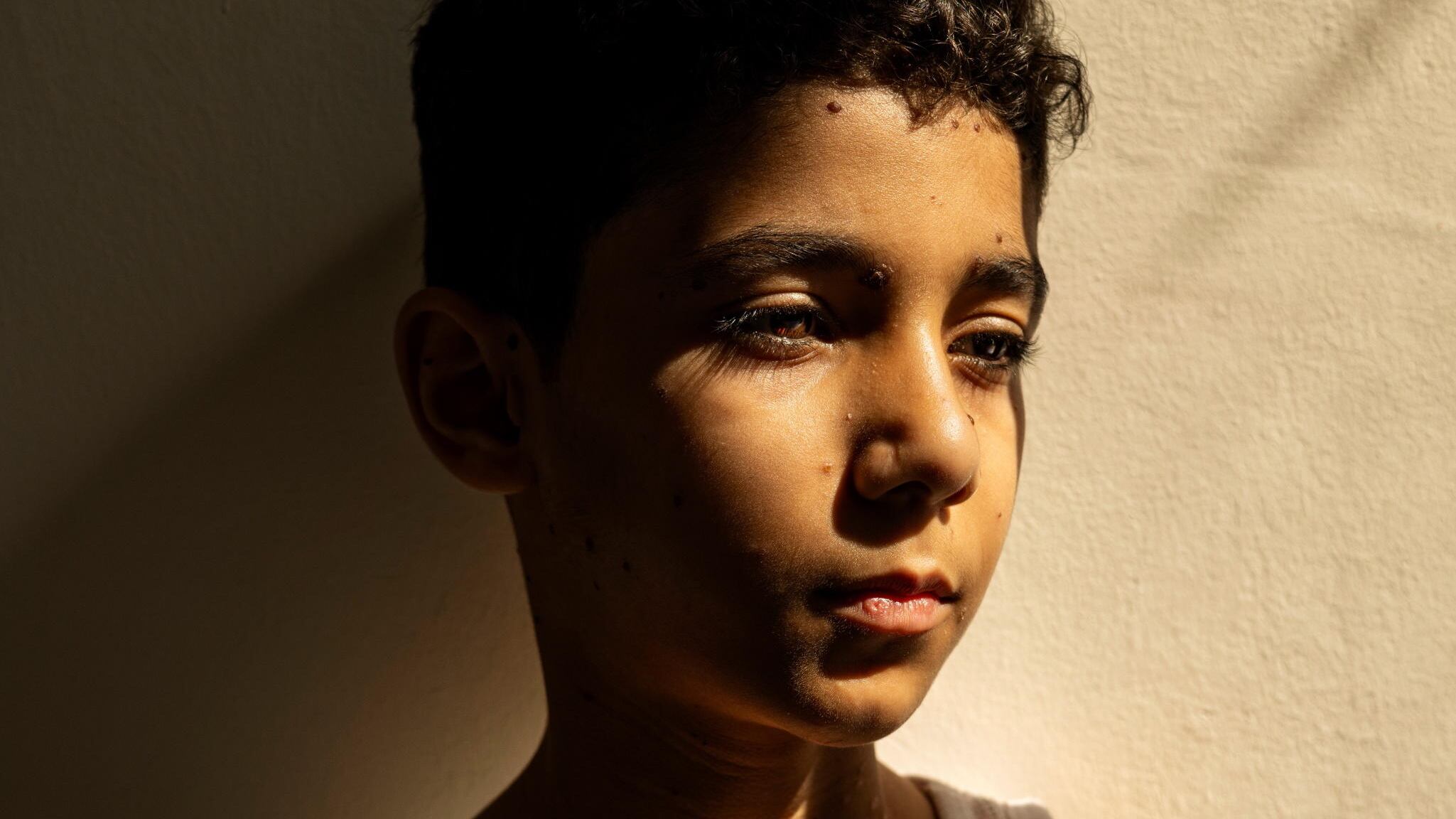 La foto premiata, Israele e la tragedia di Gaza. Ma l'immagine non racconta le colpe di Hamas