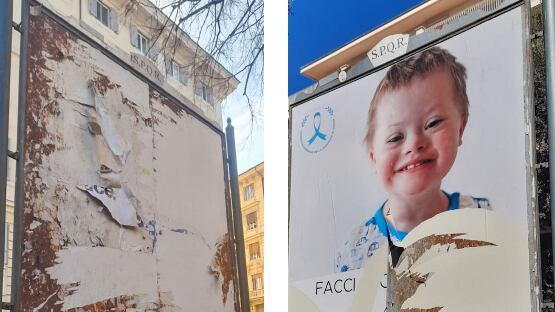Sindrome di Down, il gesto choc degli estremisti: cos'hanno fatto ai manifesti