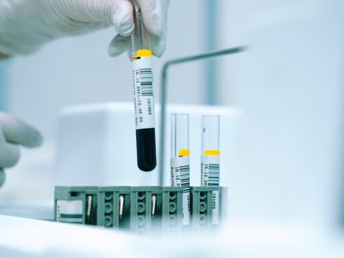 Scovare un tumore con le analisi del sangue: come funziona il test