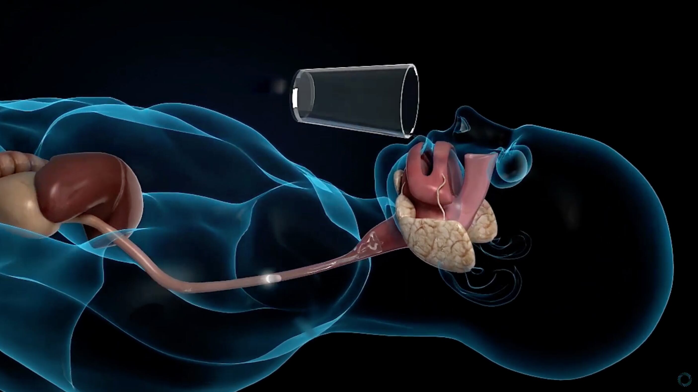Gastroscopia con videocapsula: anteprima mondiale al Gemelli