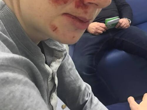 Ragazzo autistico pestato dai bulli per cinque sterline