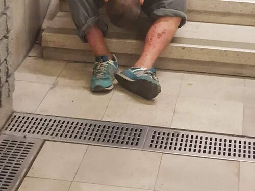 Milano, degrado choc in metro: gambe maciullate dalla droga