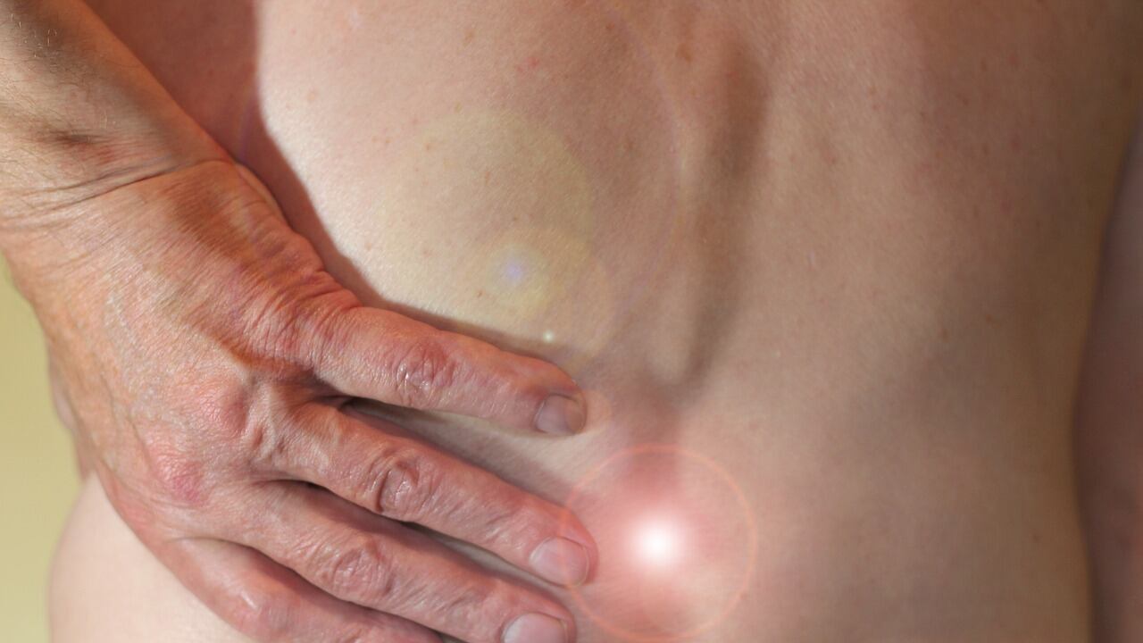 Sciatica: cause e come curarla con rimedi naturali veloci