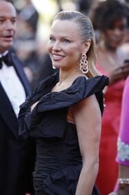Cannes, Pamela Anderson sul red carpet con il braccio pieno i lividi 4