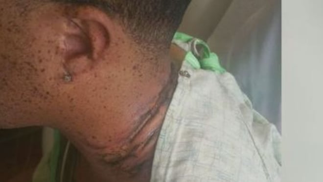 Dorme vicino al cellulare in carica. Folgorato da scarica da 110 volt