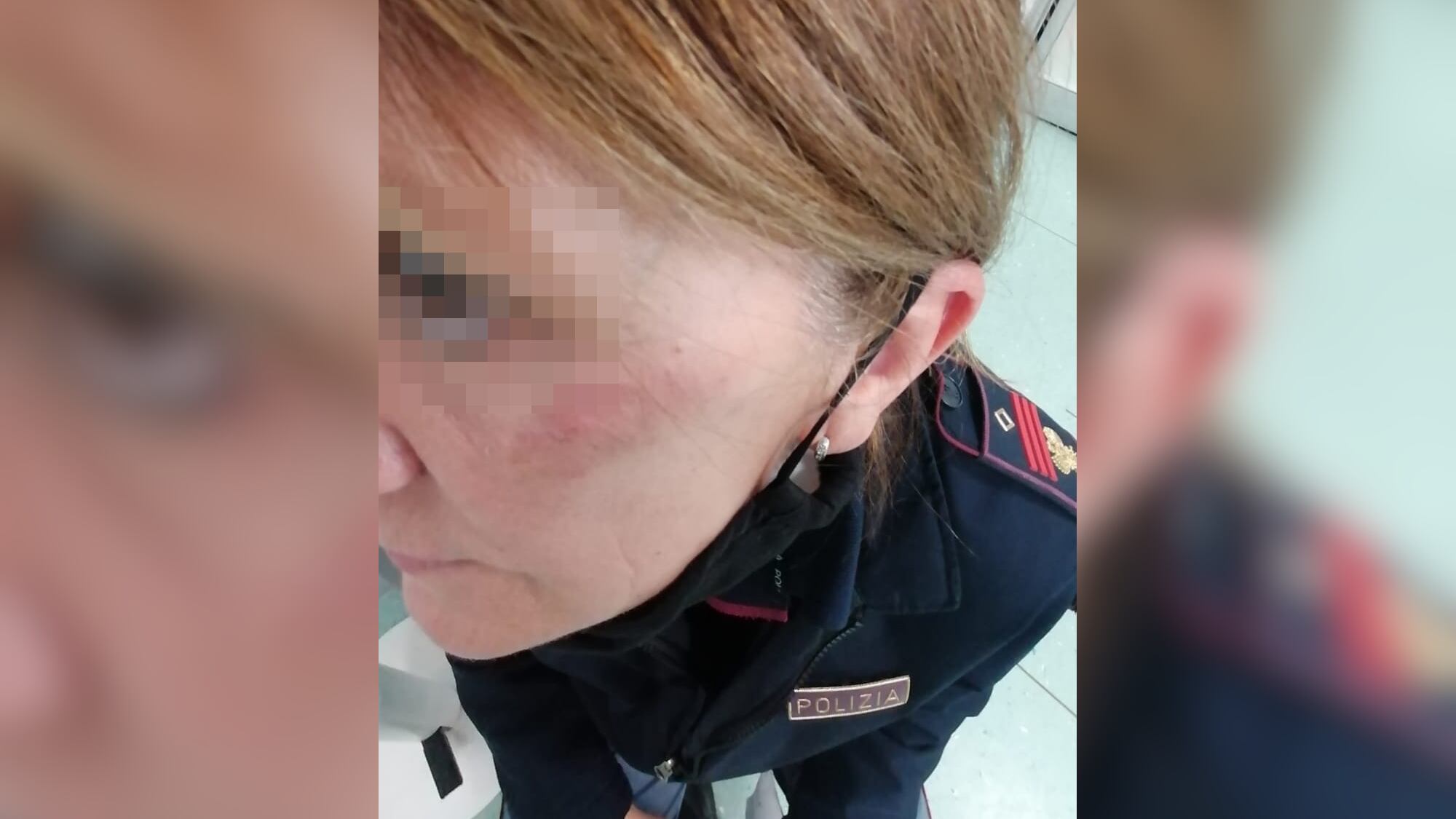 Calci e pugni contro l'agente: la furia della donna durante il controllo anti Covid