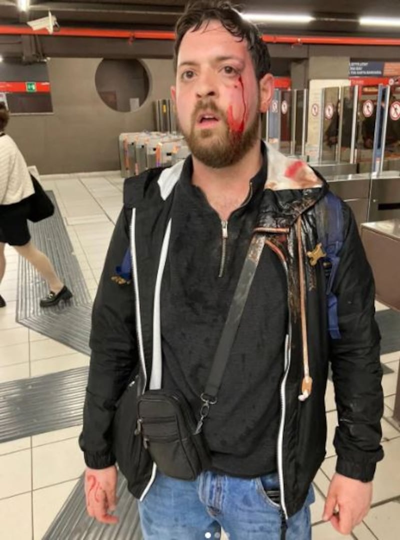 Matthia Pezzoni aggredito dalle borseggiatrici in metropolitana 3