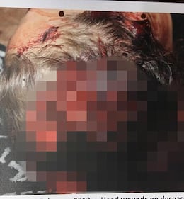 Ecco le foto dell'omicidio di Reeva Steenkamp  3