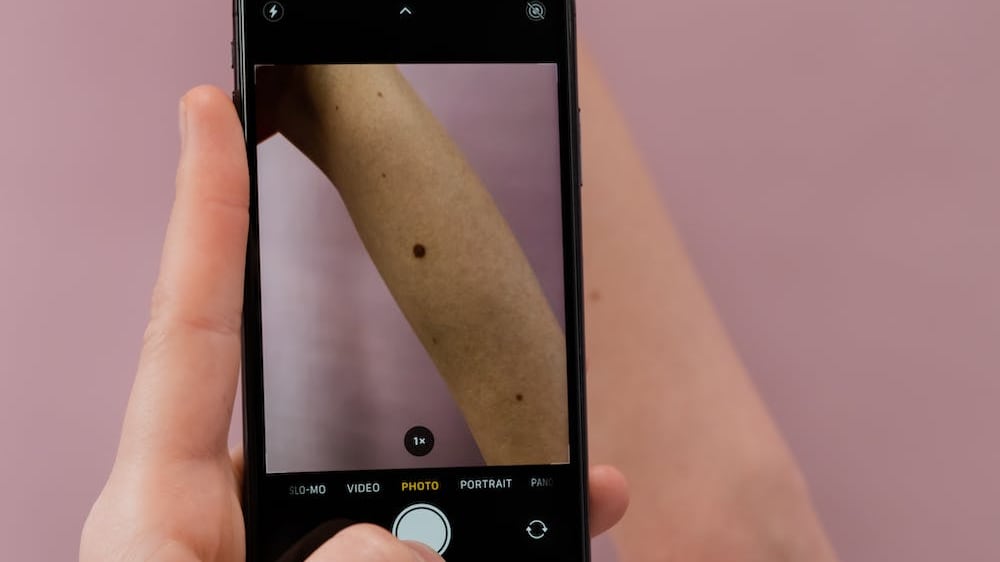 Teledermatologia: cos'è, come funziona e quali sono i vantaggi