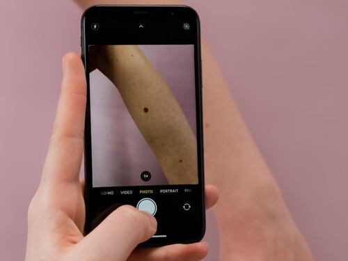 Teledermatologia: cos'è, come funziona e quali sono i vantaggi