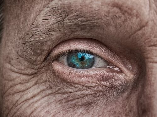 Glaucoma: in arrivo collirio ricavato dal cordone ombelicale