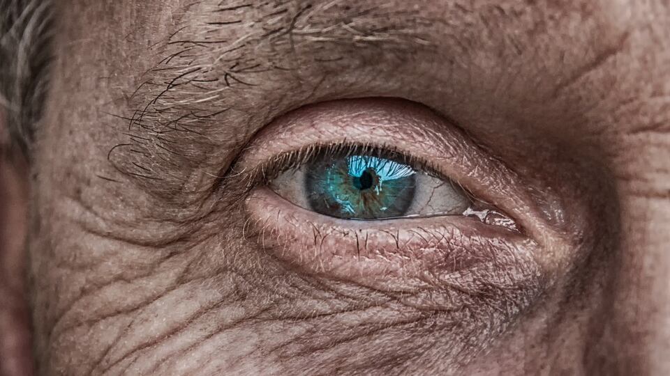 Glaucoma: in arrivo collirio ricavato dal cordone ombelicale