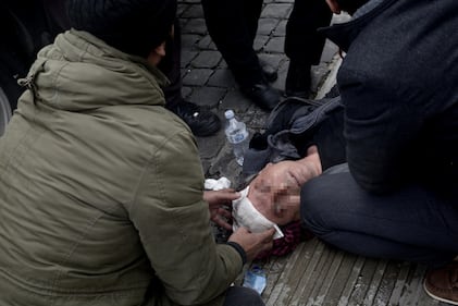A Roma scontri alla manifestazione contro Erdogan 7