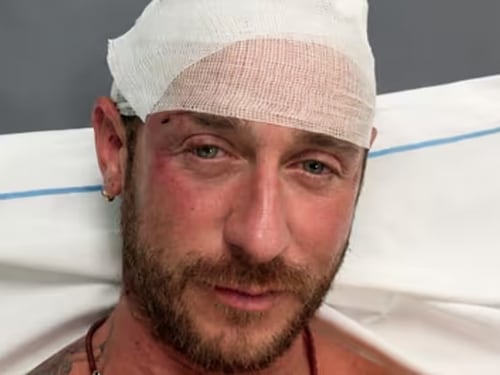 Odio in Sardegna. “Erano in trenta. Io picchiato perché sono gay”