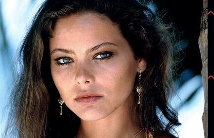 Così il botox ha trasformato le star 1