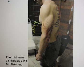 Pistorius, le foto dell'omicidio 6