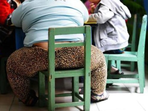 L’obesità in Italia costa un miliardo all’anno