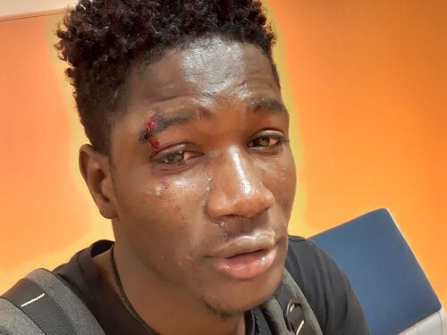 "Negro di m... vai via": baby gang picchia senegalese in pieno centro