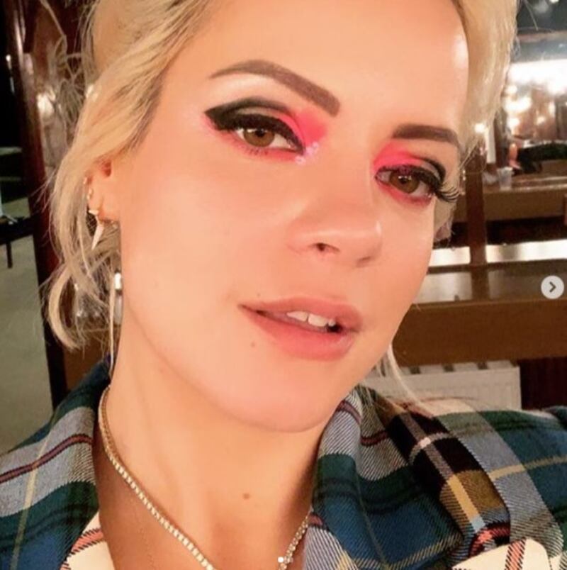 Lily Allen, le immagini più sexy 1