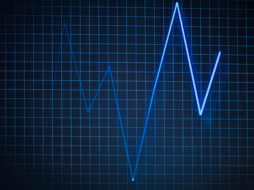 Intervento di cardiochirurgia con la realtà aumentata: il primo in Italia