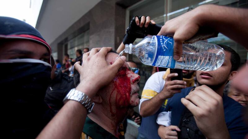 Venezuela, manifestazioni contro Maduro 6