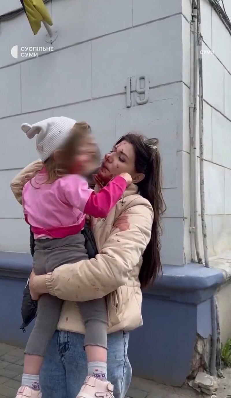 Strage di civili a Sumy nella Domenica delle Palme 1