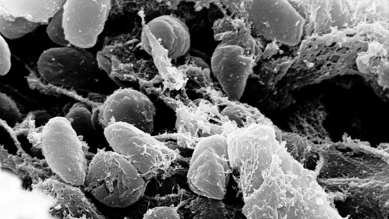 Peste bubbonica, uomo contagiato dal gatto: ecco i sintomi e come colpisce