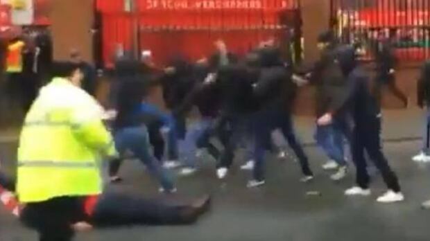 Liverpool, raccolta fondi per il tifoso pestato da ultra Roma