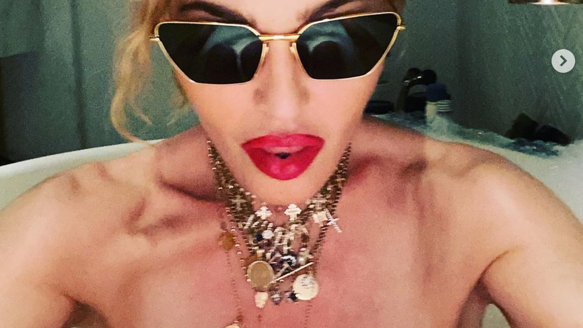 Madonna cade dal palco e scoppia in lacrime: la showgirl in ospedale