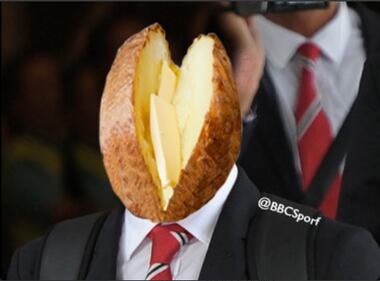 Rooney, le foto dell'infortunio e la satira sul web 2